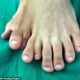 Chinese Man Born with Nine Toes